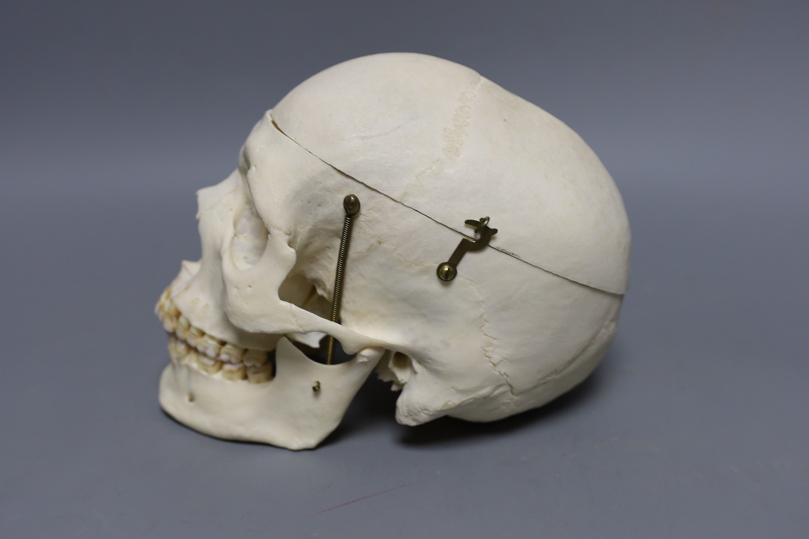 A human male skull, the vendor bought the item prior to 1977